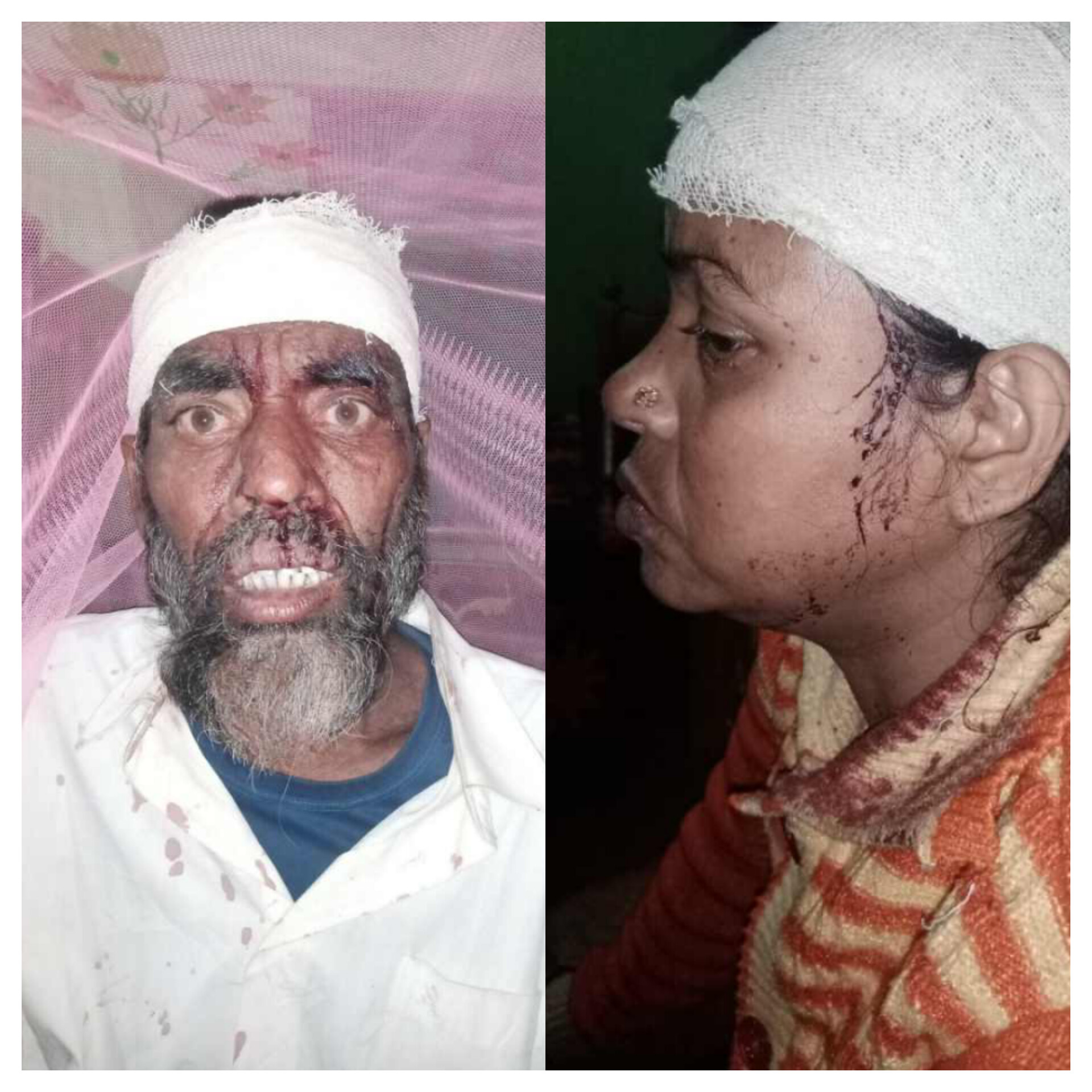 পূর্ব শত্রুতার জেরে এক দম্পতিকে পিটিয়ে রক্তাক্ত জখম!